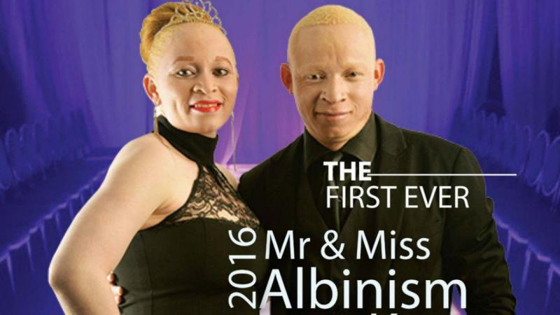 Mr e Miss Albinos 2016