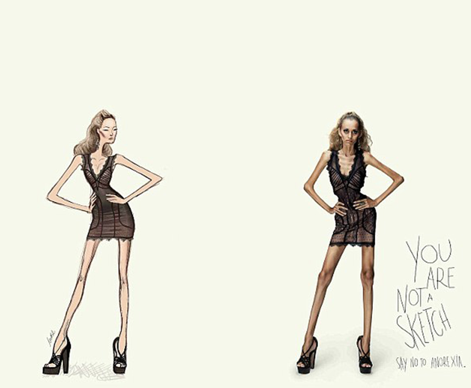 Campanha contra a anorexia «Tu não és um esboço»