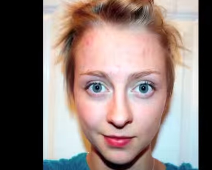 Rebecca Brown tem uma doença mental que a faz arrancar cabelos quando está nervosa (YouTube)