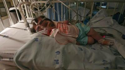 Bebé Matilde nos cuidados intensivos após cirurgia - TVI