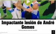 Como a imprensa internacional viu a lesão de André Gomes