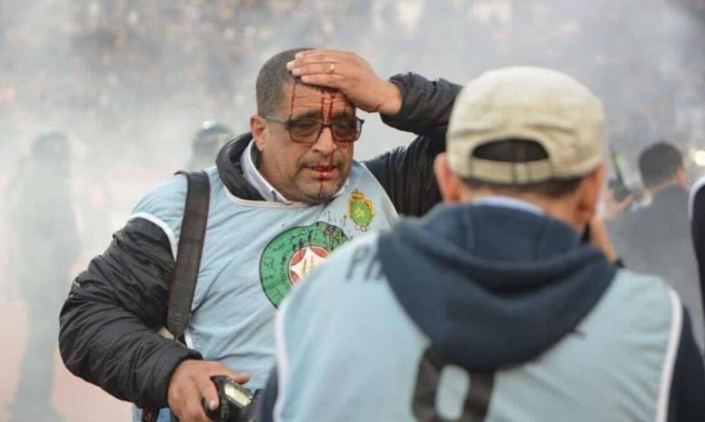 Mais de vinte feridos em clássico do futebol marroquino