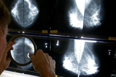 Rastreio do cancro da mama vai começar mais cedo e acabar mais tarde em Portugal - TVI
