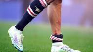 Cristiano Ronaldo a sangrar da perna