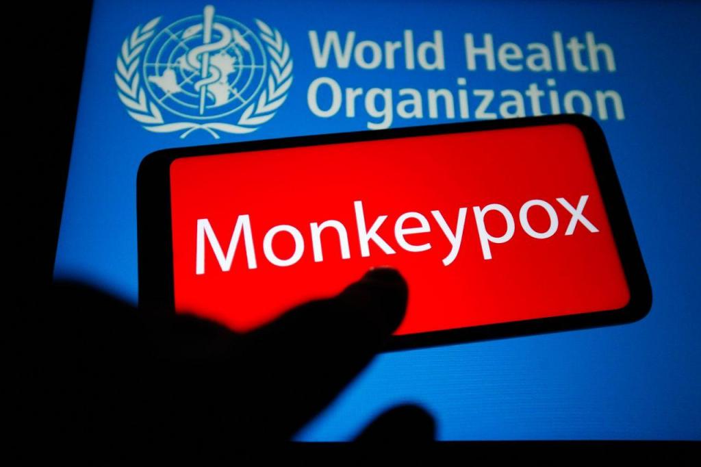 Monkeypox (GettyImages)