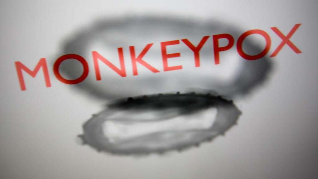 Monkeypox (GettyImages)
