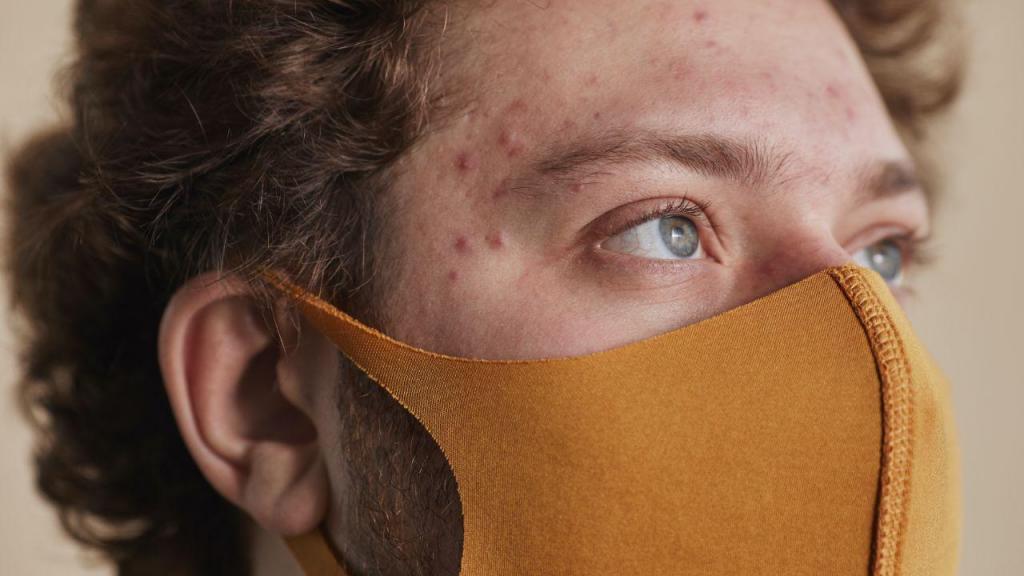 O uso de máscara contribuiu para o aparecimento de lesões na pele, como acne e rosáceas (Pexels)
