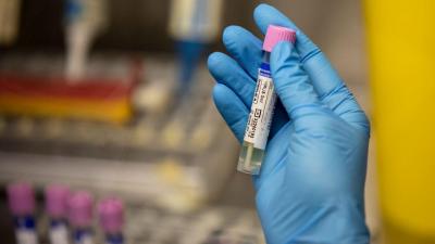 Mpox: DGS alarga critérios para vacinção preventiva - TVI