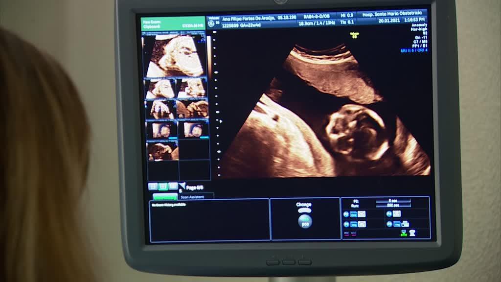 Urgências de obstetrícia: seis maternidades vão encerrar blocos de partos nos próximos dias. Saiba quais