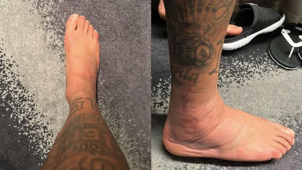 Neymar mostra o estado do tornozelo este sábado, dois dias depois do Brasil-Sérvia