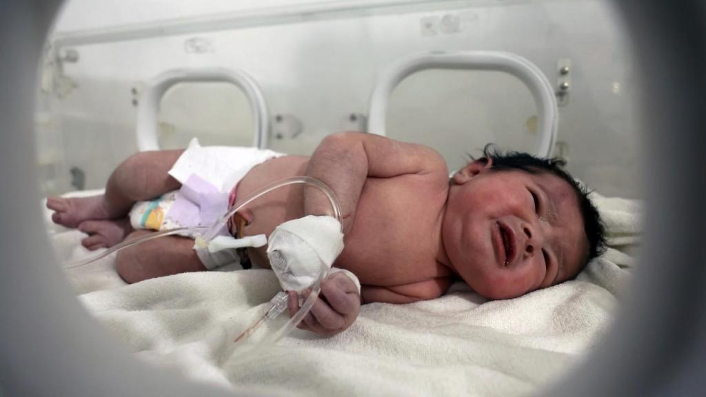 Bebé recém-nascida encontrada nos escombros, após o tremor de terra que abalou a Turquia e a Síria (Ghaith Alsayed/AP)