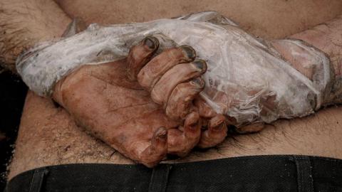 Vítima do massacre de Bucha encontrado com as mãos atadas Foto: Vadim Ghirda/AP