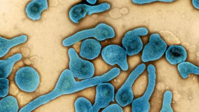 Vírus Marburg: mais oito casos detetados pela OMS na Guiné Equatorial - TVI