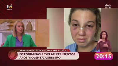 Jovens partem nariz a aluna durante agressões - TVI