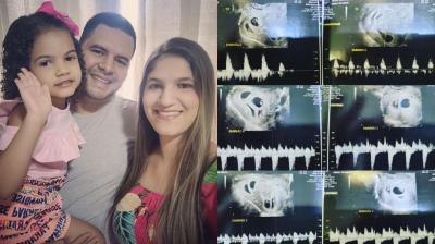 “O choque foi muito grande" e "a nossa vida mudou radicalmente”. Mulher brasileira descobre que está grávida de seis bebés - TVI