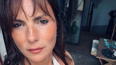 Joana Seixas submete-se a tratamento no rosto - TVI