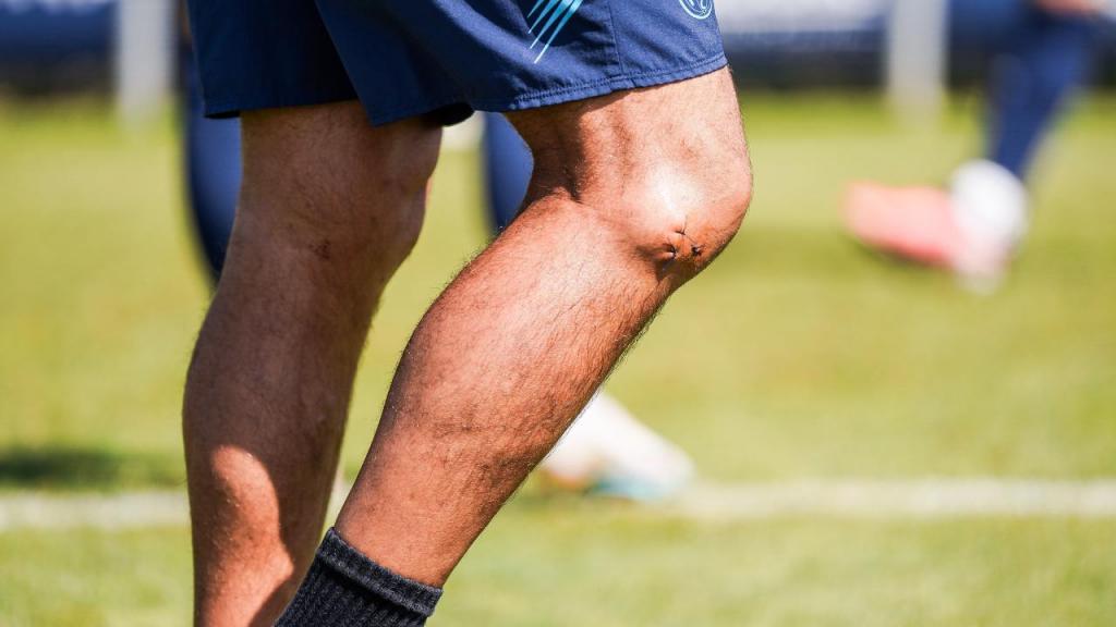 Cicatriz no joelho de Sérgio Conceição
