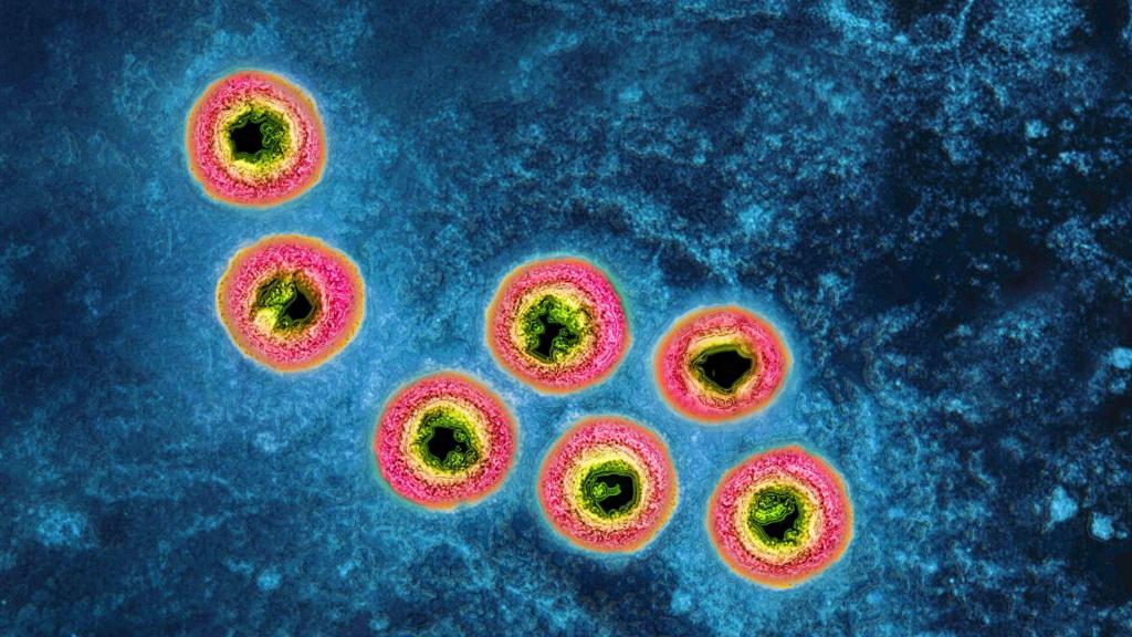Imagem do vírus do herpes humano obtida com microscopia eletrónica de transmissão .(BSIP/Universal Images Group via Getty Images)