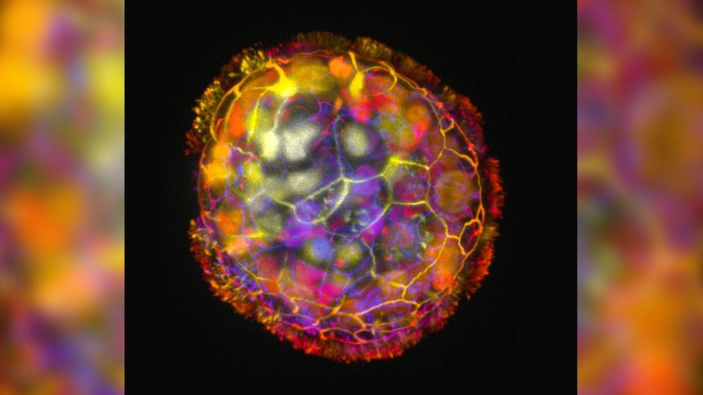 Uma imagem colorida mostra a estrutura multicelular de um antrobô, rodeado de cílios na sua superfície, o que lhe permite mover-se e explorar o seu ambiente. Gizem Gumuskaya/Tufts University