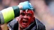 Adepto maltratado durante o West Bromwich Albion-Wolverhampton Wanderers (Getty Images/Getty Images)